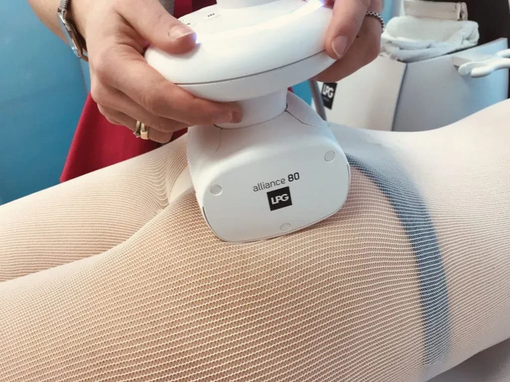 Endermologia LPG - co to jest i jak może odmienić Twoją skórę